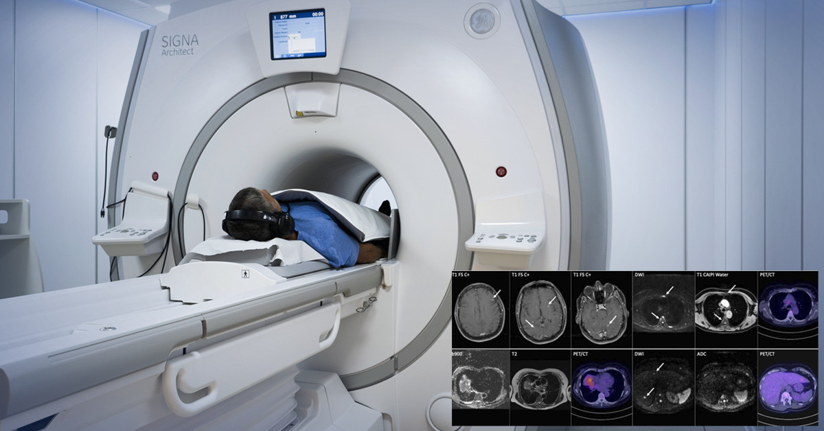 Mri Teljes Test Copy
