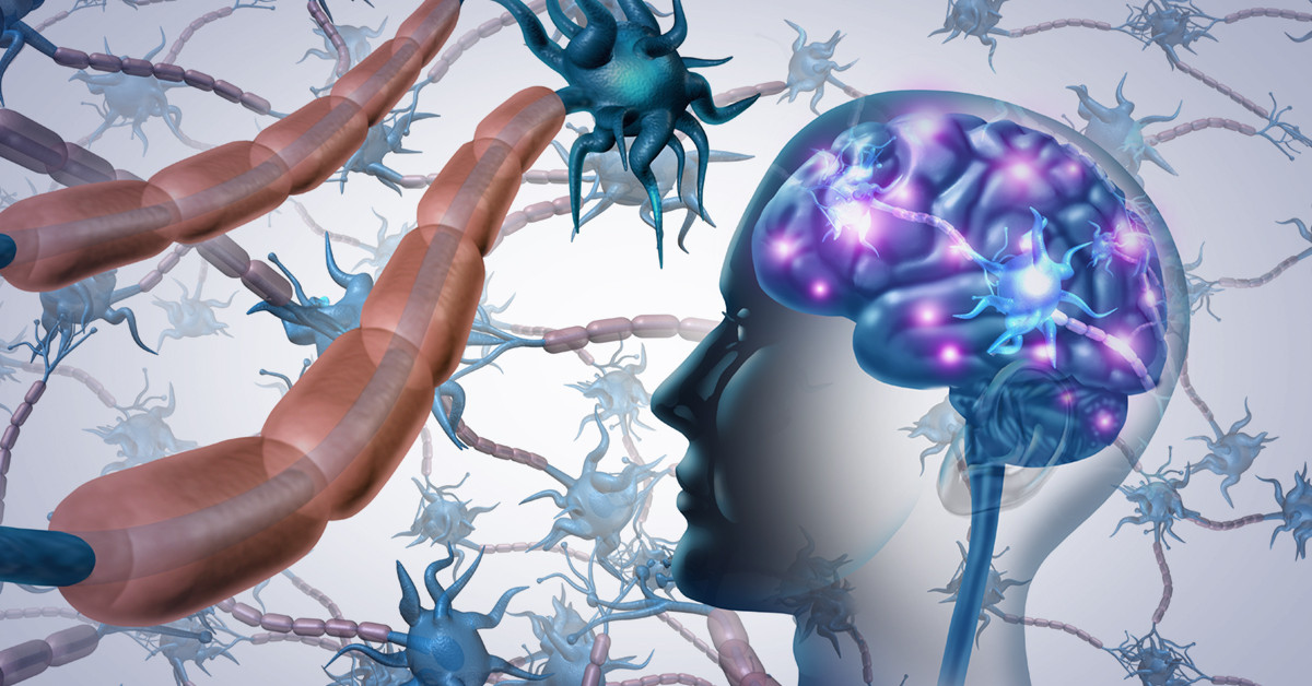 Sclerosis Virus Poszt